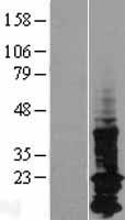 LAPTM5 Human Over-expression Lysate