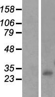 INMT Human Over-expression Lysate