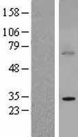 BTG3 Human Over-expression Lysate