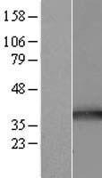 TOMM34 Human Over-expression Lysate