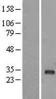 RAB40B Human Over-expression Lysate