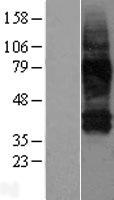 SLC38A3 Human Over-expression Lysate