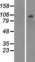 DNMT3B Human Over-expression Lysate