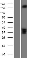 RASGRF2 Human Over-expression Lysate