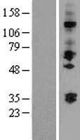 ST3GAL2 Human Over-expression Lysate