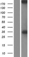 SPTBN2 Human Over-expression Lysate