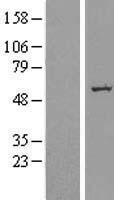 SLC39A7 Human Over-expression Lysate