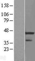 RNF113A Human Over-expression Lysate