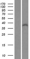 ZNF32 Human Over-expression Lysate