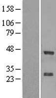 ZNF24 Human Over-expression Lysate