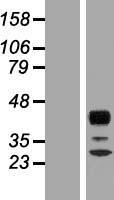 RPH3AL Human Over-expression Lysate