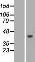 LECT1 (CNMD) Human Over-expression Lysate