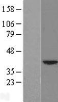 Heat Shock Factor 2 Binding Protein (HSF2BP) Human Over-expression Lysate