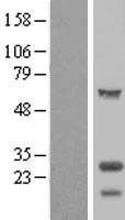 Tubulin Polymerization Promoting Protein (TPPP) Human Over-expression Lysate