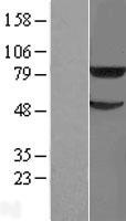 TRIM31 Human Over-expression Lysate