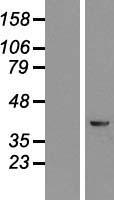 KRR1 Human Over-expression Lysate