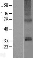 PL6 (TMEM115) Human Over-expression Lysate