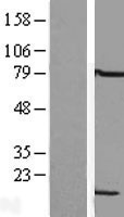 LSM6 Human Over-expression Lysate