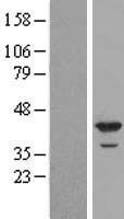 DMC1 Human Over-expression Lysate