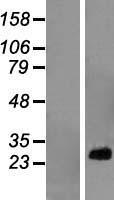 RPL10A Human Over-expression Lysate