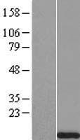 Uroguanylin (GUCA2B) Human Over-expression Lysate