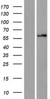ZNF75 (ZNF75D) Human Over-expression Lysate