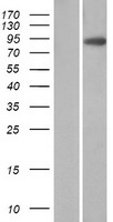 Villin (VIL1) Human Over-expression Lysate