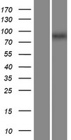 ZXDA Human Over-expression Lysate