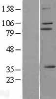 ZNF175 Human Over-expression Lysate