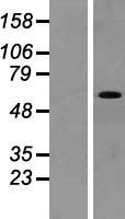 ZNF161 (VEZF1) Human Over-expression Lysate