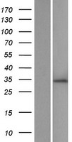 ZNF146 Human Over-expression Lysate
