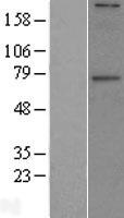 GALNT6 Human Over-expression Lysate