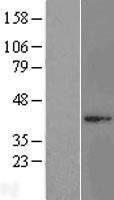 MRPL3 Human Over-expression Lysate
