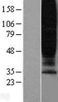 GPR45 Human Over-expression Lysate