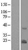 Nurim (NRM) Human Over-expression Lysate