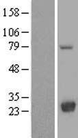 LYPLA2 Human Over-expression Lysate