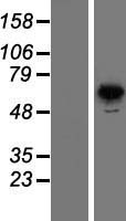 PNK (PNKP) Human Over-expression Lysate