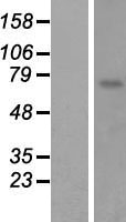 CYPIVF8 (CYP4F8) Human Over-expression Lysate