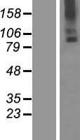 TMC6 Human Over-expression Lysate
