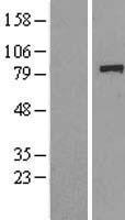 SGT1 (ECD) Human Over-expression Lysate