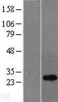 OIP5 Human Over-expression Lysate