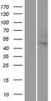 G protein alpha 12 (GNA12) Human Over-expression Lysate