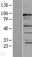 CASC3 Human Over-expression Lysate