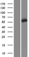 TCP1 epsilon (CCT5) Human Over-expression Lysate
