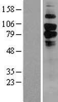 CD93 Human Over-expression Lysate