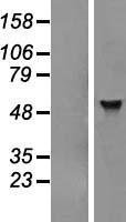 ADAT1 Human Over-expression Lysate