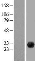 PGLS Human Over-expression Lysate