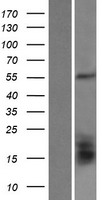 GLUD2 Human Over-expression Lysate