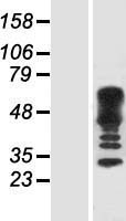 CDC42EP4 Human Over-expression Lysate