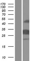 Caspase 14 (CASP14) Human Over-expression Lysate